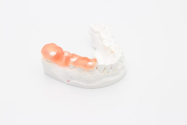 サージカルガイド